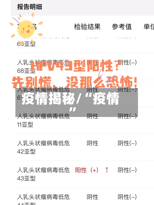 疫情揭秘/“疫情”-第2张图片