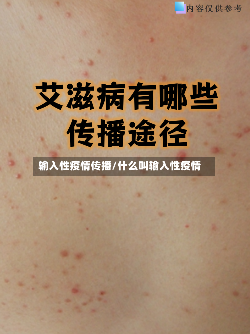 输入性疫情传播/什么叫输入性疫情