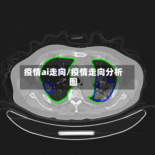 疫情ai走向/疫情走向分析图-第2张图片
