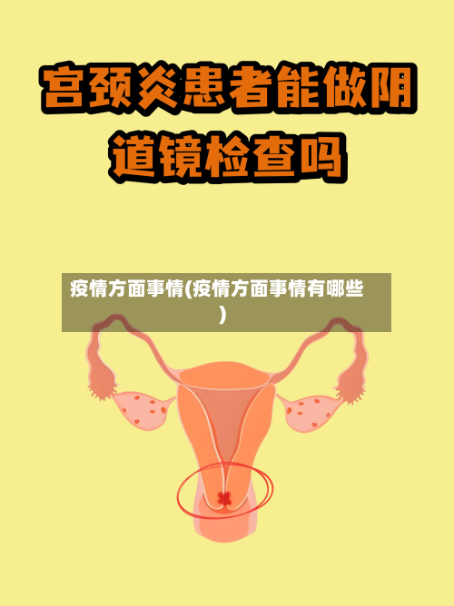 疫情方面事情(疫情方面事情有哪些)-第2张图片