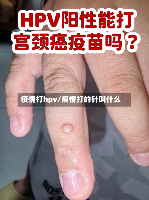 疫情打hpv/疫情打的针叫什么