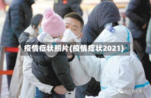 疫情症状照片(疫情症状2021)-第3张图片
