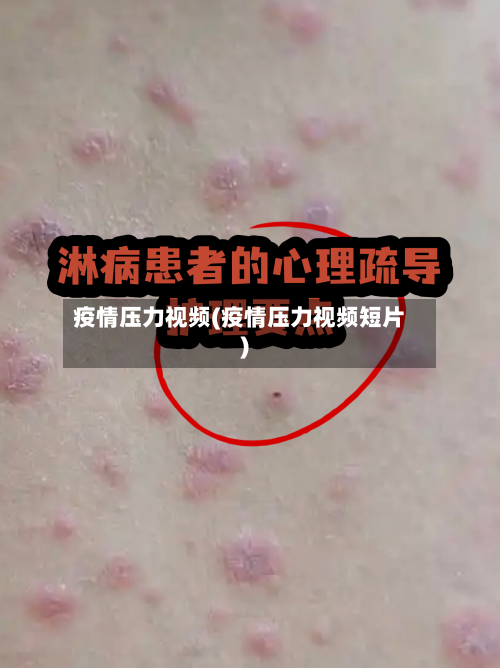 疫情压力视频(疫情压力视频短片)