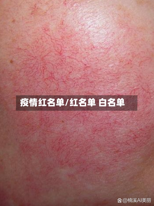 疫情红名单/红名单 白名单-第3张图片