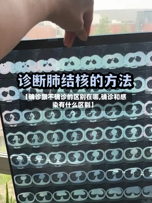 【确诊跟不确诊的区别在哪,确诊和感染有什么区别】-第2张图片