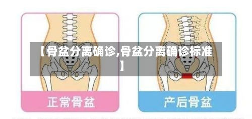 【骨盆分离确诊,骨盆分离确诊标准】-第3张图片