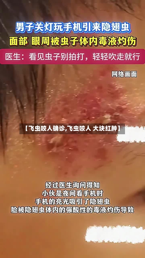 【飞虫咬人确诊,飞虫咬人 大块红肿】-第2张图片