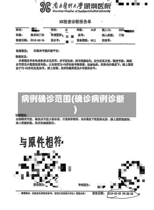 病例确诊范围(确诊病例诊断)-第3张图片