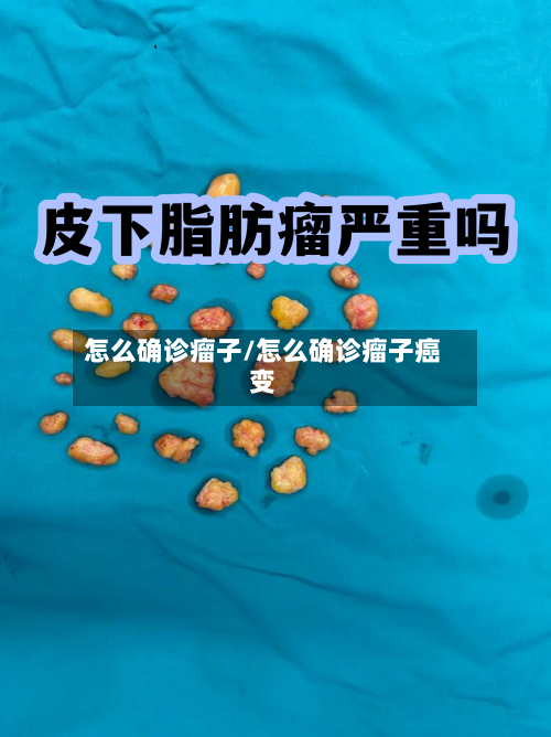 怎么确诊瘤子/怎么确诊瘤子癌变