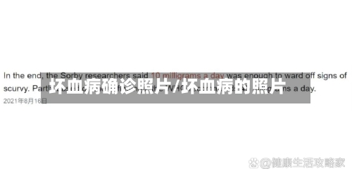 坏血病确诊照片/坏血病的照片-第2张图片
